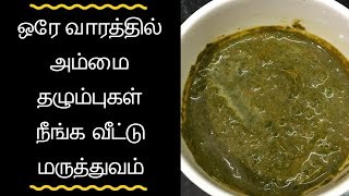 Ammai thalumbu maraiya tips in tamil  Remove Chicken Pox Marks in Tamil  அம்மை தழும்பு நீங்க [upl. by Eedolem935]