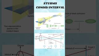 Astigmatism shortvideio viralshort ytshorts [upl. by Arias84]