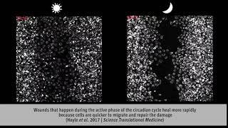 Fibroblasts migrate to heal a wound [upl. by Tome]