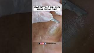 SATISFYING CALLUS TRIM FROM SIDE OF FEET 2022 BY FOOT SPECIALIST MISS FOOT FIXER [upl. by Waldack]