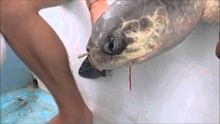 海龜鼻孔有吸管 Removing a plastic straw from a sea turtles nostril  Short Version 中文翻譯 [upl. by Gearard]