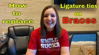 How to replace ligature tie or O Rings on Braces  How braces ties with Ligature ties [upl. by Airetnohs]