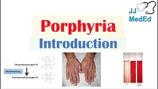 Introduction to Porphyria  Porphyria Cutanea Tarda vs Acute Intermittent Porphyria [upl. by Grof]