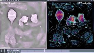 4 mESCs Mitosis synced up [upl. by Illib]