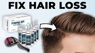 Men How To Fix Hair Loss At Home Full Guide [upl. by Aldwin869]