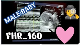 MALE BABY SIGNS ON ULTRASOUND AND INCREASED HEART RATE😎I Beta Hone Ki Nashynia in HindiUrdu I [upl. by Hirai525]