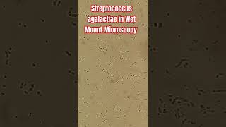 Visualizing Streptococcus agalactiae Insights from Wet Mount Microscopy and Culture Techniques [upl. by Ylimme]