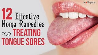 12 Effective Remedies For Treating Tongue Sores  Healthspectra [upl. by Notxarb808]