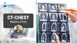 CT Chest  Basics First [upl. by Griffiths674]