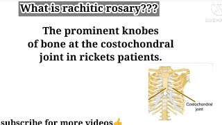 What is rachitic rosary  Rachitic Rosary vitamin C deficient disease  Basic concept building [upl. by Dranoel]