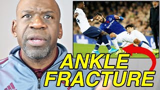 Doctor Reacts to Soccer Injuries ANDRE GOMES INJURY Ankle Fracture [upl. by Egres269]