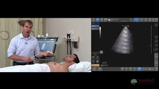 Point of Care Lung Ultrasound POCUS [upl. by Yorker]