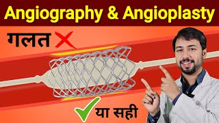 जानिए Angiography amp Angioplasty kya hai or kaise hoti hai  Angiography test procedure  angioplasty [upl. by Goulet905]