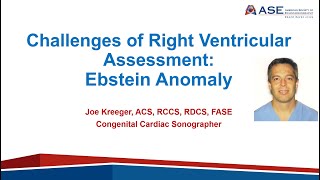 Challenges of Right Ventricular Assessment in Ebsteins Anomaly Using Echocardiography [upl. by Lynn]