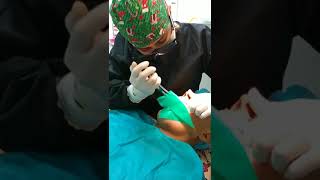 Cómo se realiza un Tratamiento de Conducto o Endodoncia paso a paso [upl. by Emearg]