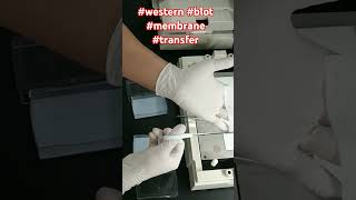 western blot membrane transfer [upl. by Sander511]