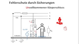 Unvollkommener Körperschluss  9 verschiedene Fälle  mit und ohne Lebensgefahr  Berechnungen [upl. by Englis]