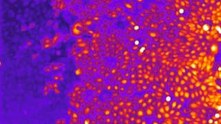 Calcium imaging in keratinocytes with Fluo4AM dye [upl. by Curhan671]