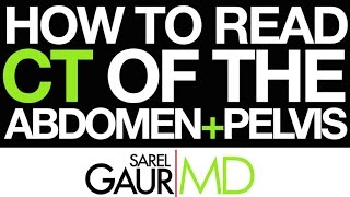 How to read CT of the Abdomen and Pelvis [upl. by Omsoc104]