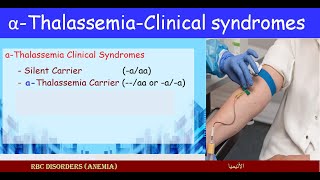 Lecture 251 Carriers alfa Thalassemia  Clinical Syndromes [upl. by Akimit693]