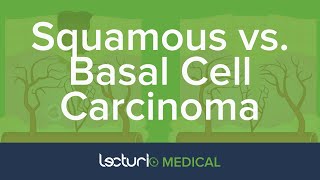 Squamous Cell Carcinoma SCC vs Basal Cell Carcinoma BCC  Dermatology [upl. by Hertz227]