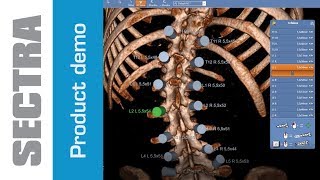 Sectra 3D Spine [upl. by Aloysia]