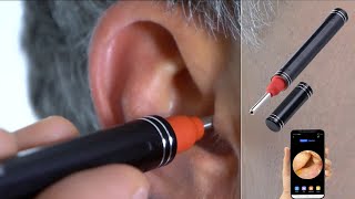 Nettoyeur doreille connecté avec caméra Full HD Newgen Medicals OTOSCOPE PEARLTVFR [upl. by Joline869]