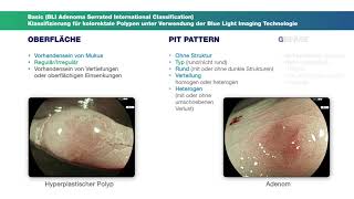 BasicKlassifikation Kolonpolypen [upl. by Amato284]