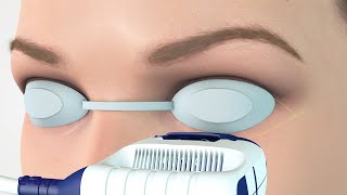 E EYE  Operating mechanism of Dry Eye treatment  EN [upl. by Okajima]