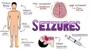 Seizures  Seizure Types  Generalized vs Focal Seizures  Causes of Seizures Mnemonic [upl. by Wixted]