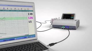 Wallach Fetal2EMR Fetal Monitor [upl. by Eunice]