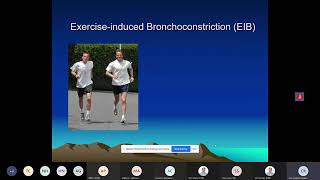 ExerciseInduced Bronchconstriction Randolph [upl. by Leorsiy]