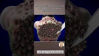 ASMR learning Animation Trick Video Treatment Head back Side [upl. by Bose]