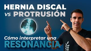 ★ Hernia discal VS Protrusión discal Cómo interpretar una resonancia  ✅ 10 EJERCICIOS [upl. by Catt]