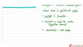 What are the steps involved in formation of a root nodule  11  MINERAL NUTRITION  BIOLOGY [upl. by Neehsuan]