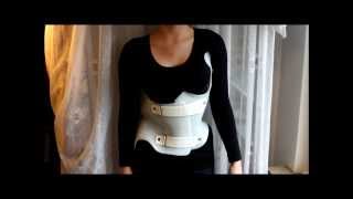 Skoliose mein NEUES Korsett aus der Kur  my new back brace [upl. by Suravaj]