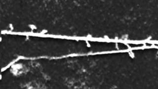 Dynamics of Dendritic Filopodia in Hippocampal Slice [upl. by Constantin]