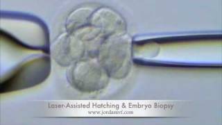 Embryo Biopsy [upl. by Tubb]