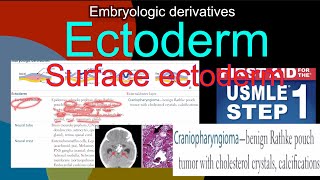 Embryologic derivatives  Ectoderm Surface ectoderm Craniopharyngioma in HindiUrdu by first aid [upl. by Godden]