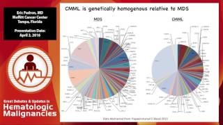 Management of CMML [upl. by Arakahs]