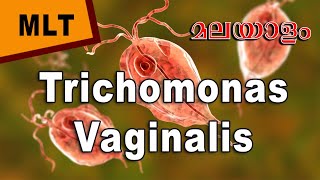 Trichomonas Vaginalis in Malayalam Morphology life cycle and laboratory diagnosis biohub [upl. by Wickner]