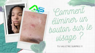 Beauté  comment éliminer rapidement un bouton sur le visage [upl. by Harrak]