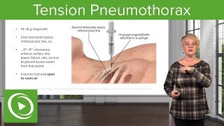 Tension Pneumothorax EMERGENCY Dont Miss This Crucial Diagnosis [upl. by Annekahs]