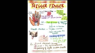 Trigger Finger  Stenosing Tenosynovitis  Orthopaedics [upl. by Sewell631]