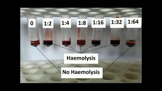 How to Determine antibody titer [upl. by Hirza]