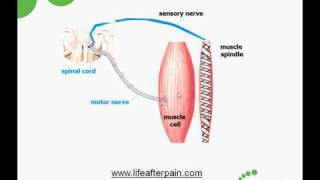 Myofascial Trigger Points Causes and Treatment [upl. by Fulks455]