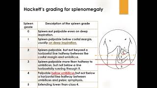 Grading For Splenomegaly  Pediatrics [upl. by Yahsal]