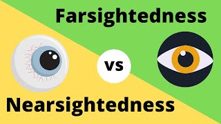 Nearsightedness and Farsightedness [upl. by Helbonnah]