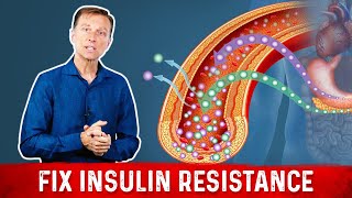 7 Things That Boost Insulin Sensitivity or Reverse Insulin Resistance  Dr Berg [upl. by Agle]