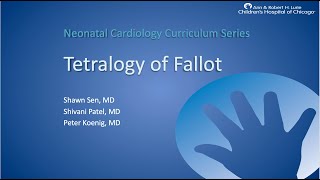 Tetralogy of Fallot [upl. by Ahsenek]